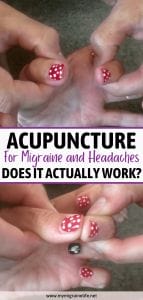 acupuncture for migraine